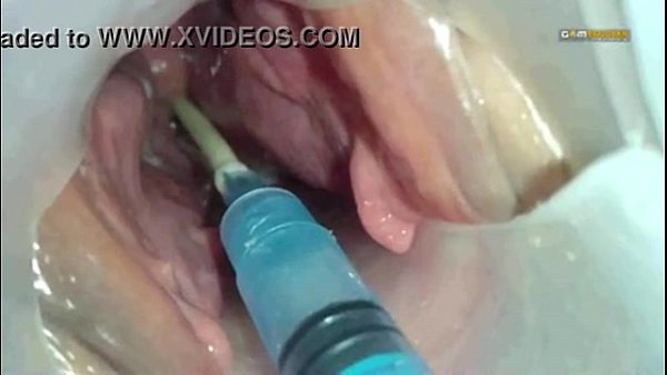 Sherry reccomend pussy injected cum