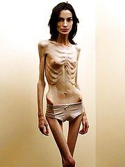 Anorexic nude photos