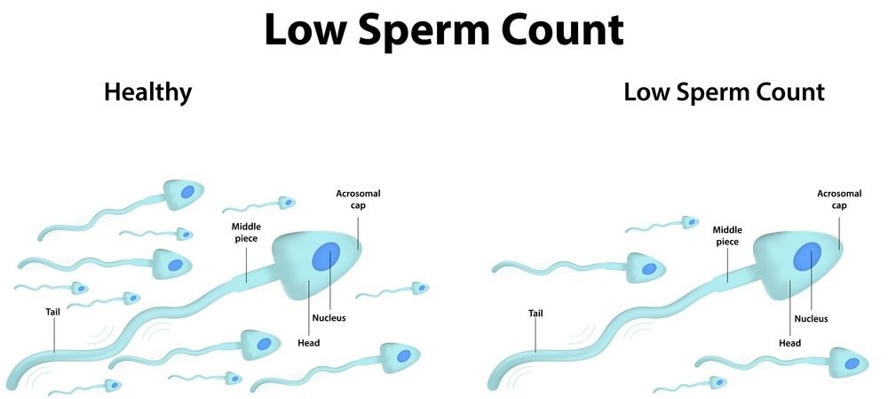 Black W. reccomend Averge sperm count