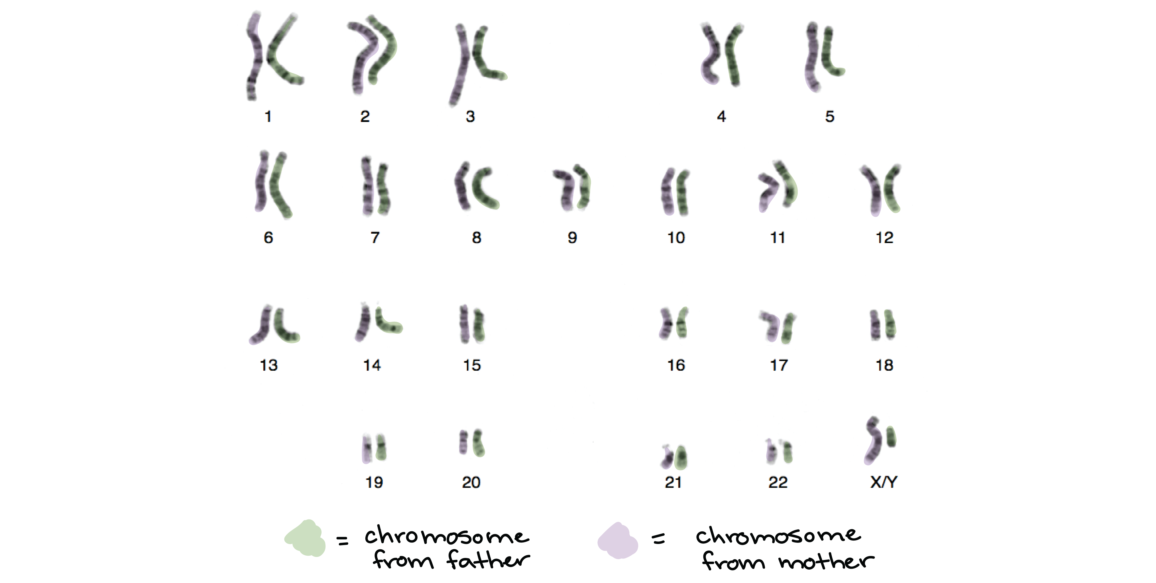 Chromosomes in sperm cells