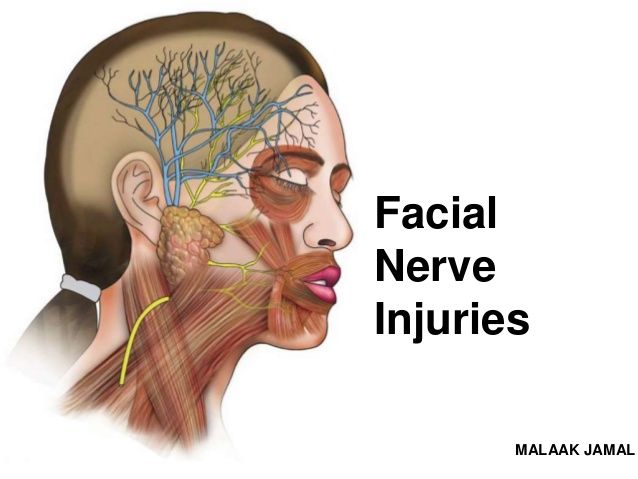 best of Injuries Pictures of facial neck