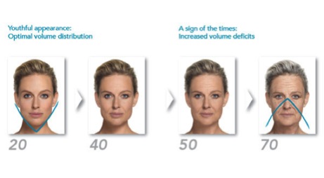 Tinkerbell reccomend Facial aging process