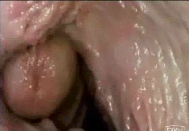 Wonder W. reccomend Camera inside vagina during sex