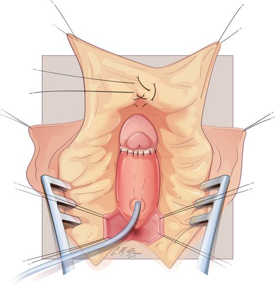 Tango reccomend Anatomy of a clitoris