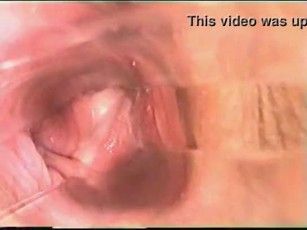 Camera inside vagina during sex